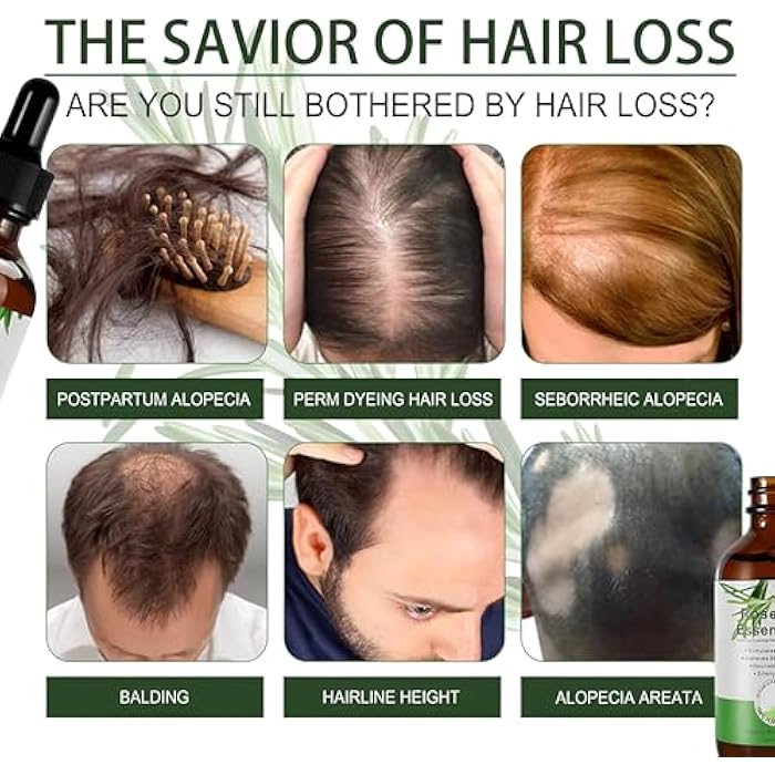 Organic Rosemary Oil 60ml - Natural Hair Growth Enhancer, Pure Aromatic Formula, Designed to Nourish and Stimulate Hair Growth for All Ages and Men - Image 3